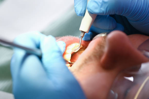 Best Emergency Dentist for Knocked-Out Tooth in Zion, IL