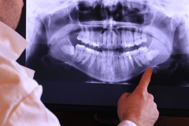 Best Weekend Emergency Dentist in Zion, IL