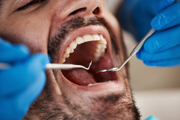 Best Pediatric Emergency Dentist in Zion, IL